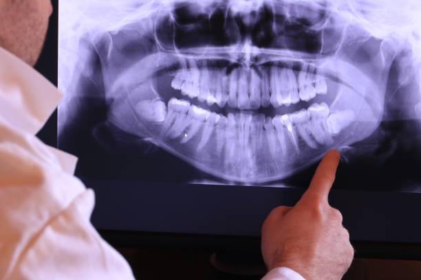 Best Weekend Emergency Dentist in Pine Ridge, SD
