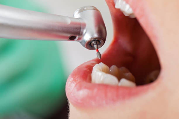 Best Emergency Root Canal Treatment in Pine Ridge, SD